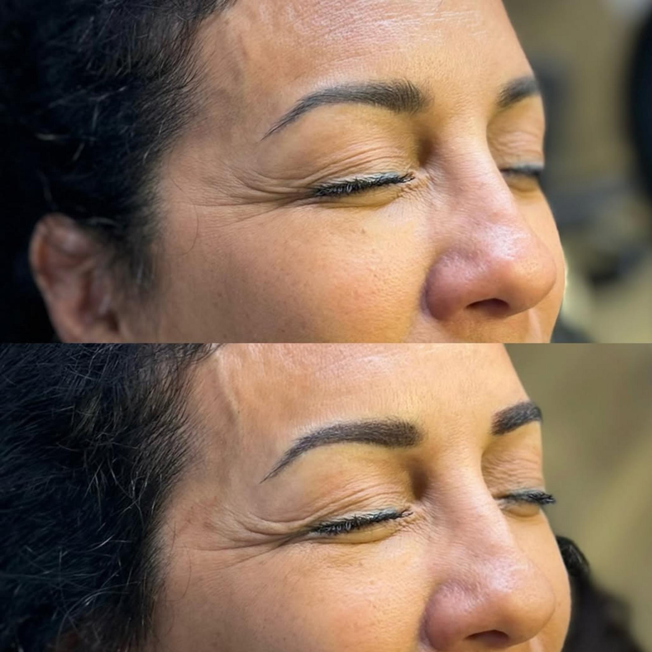 correction of uneven eyebrow tattoo