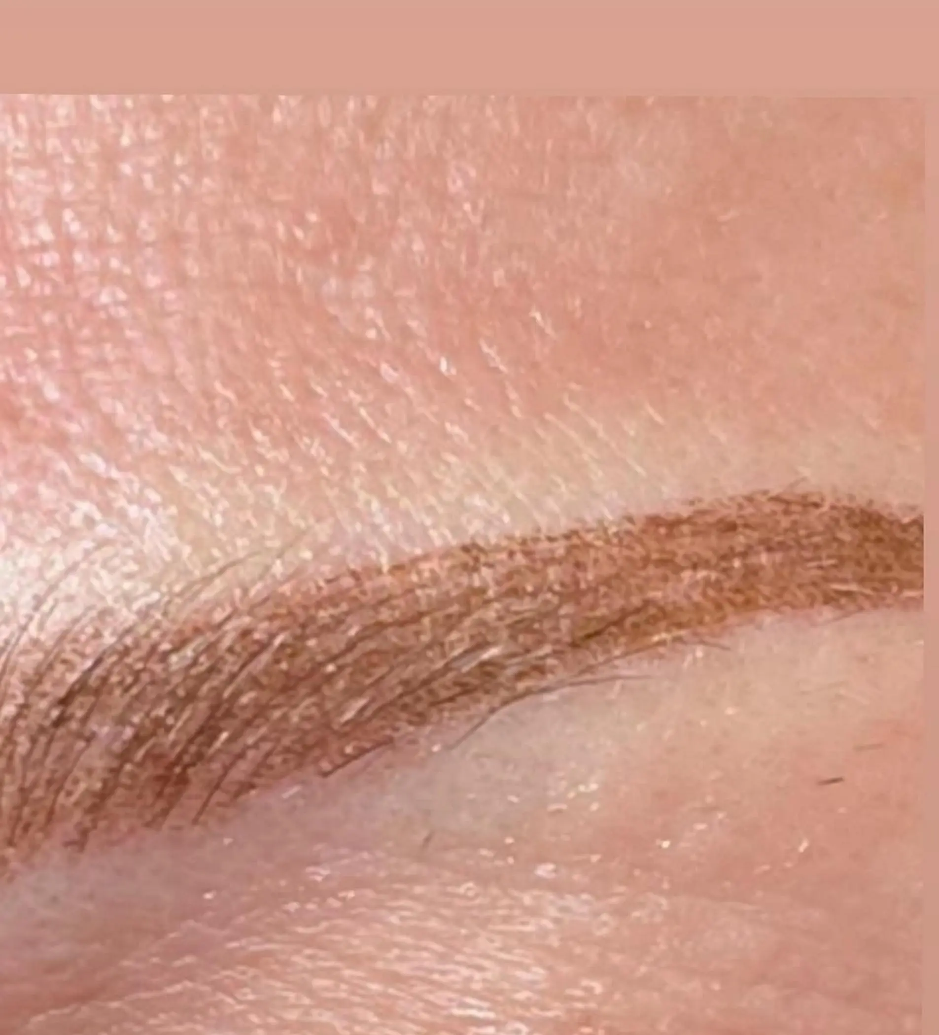 healing stage flaking eyebrows close view