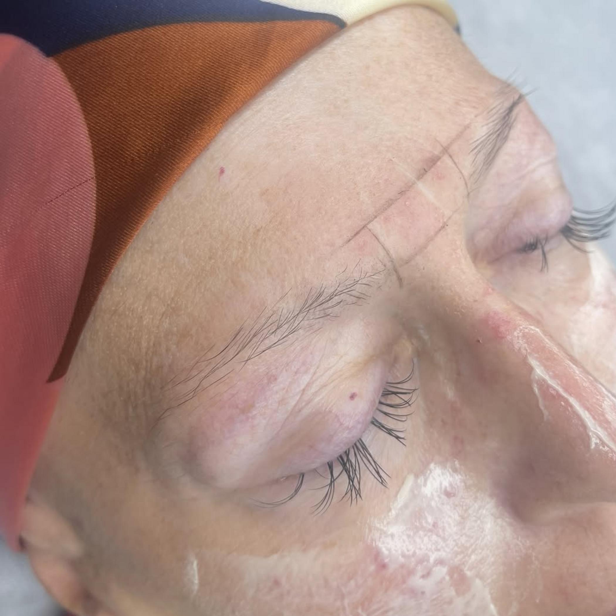 hybrid brow shading procedure