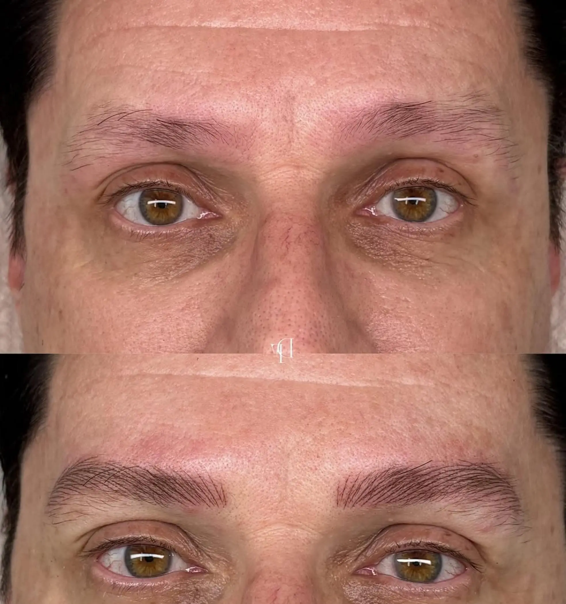 ombre brow healing day ten progress