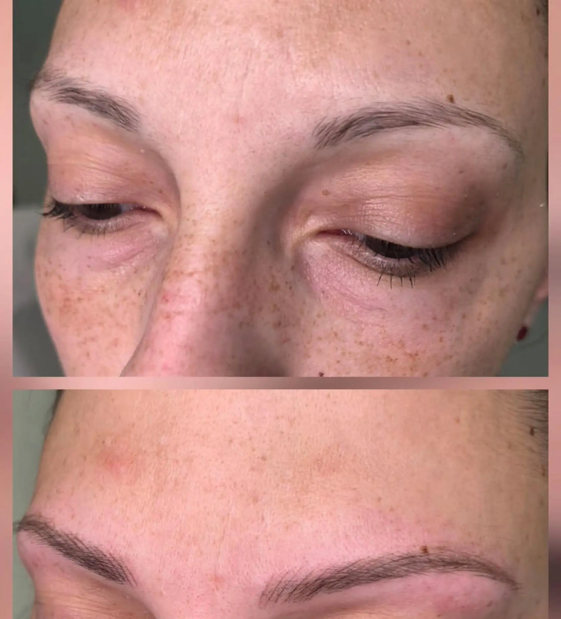 saline removal correction eyebrow tattoo case