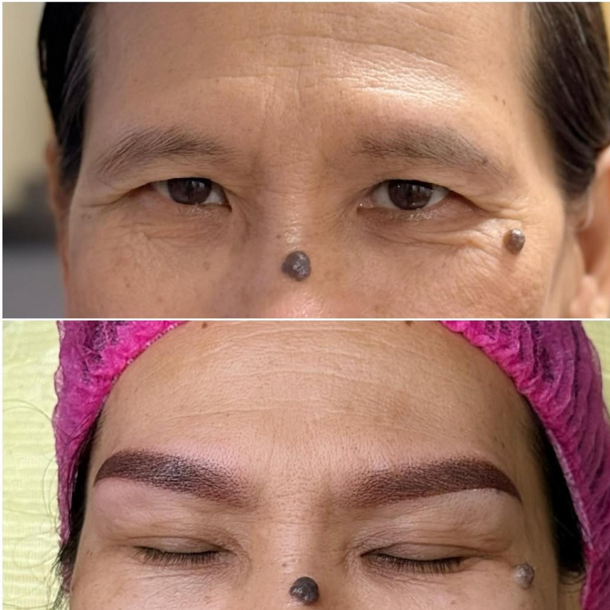 technician performing microshading process